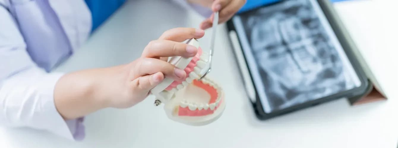 Костная пластика