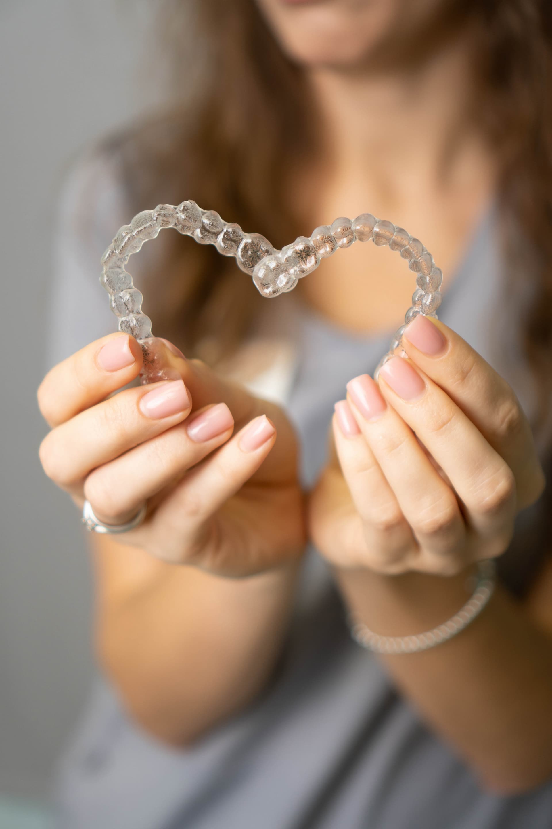 Рассрочка на лечение элайнерами EUROKAPPA.