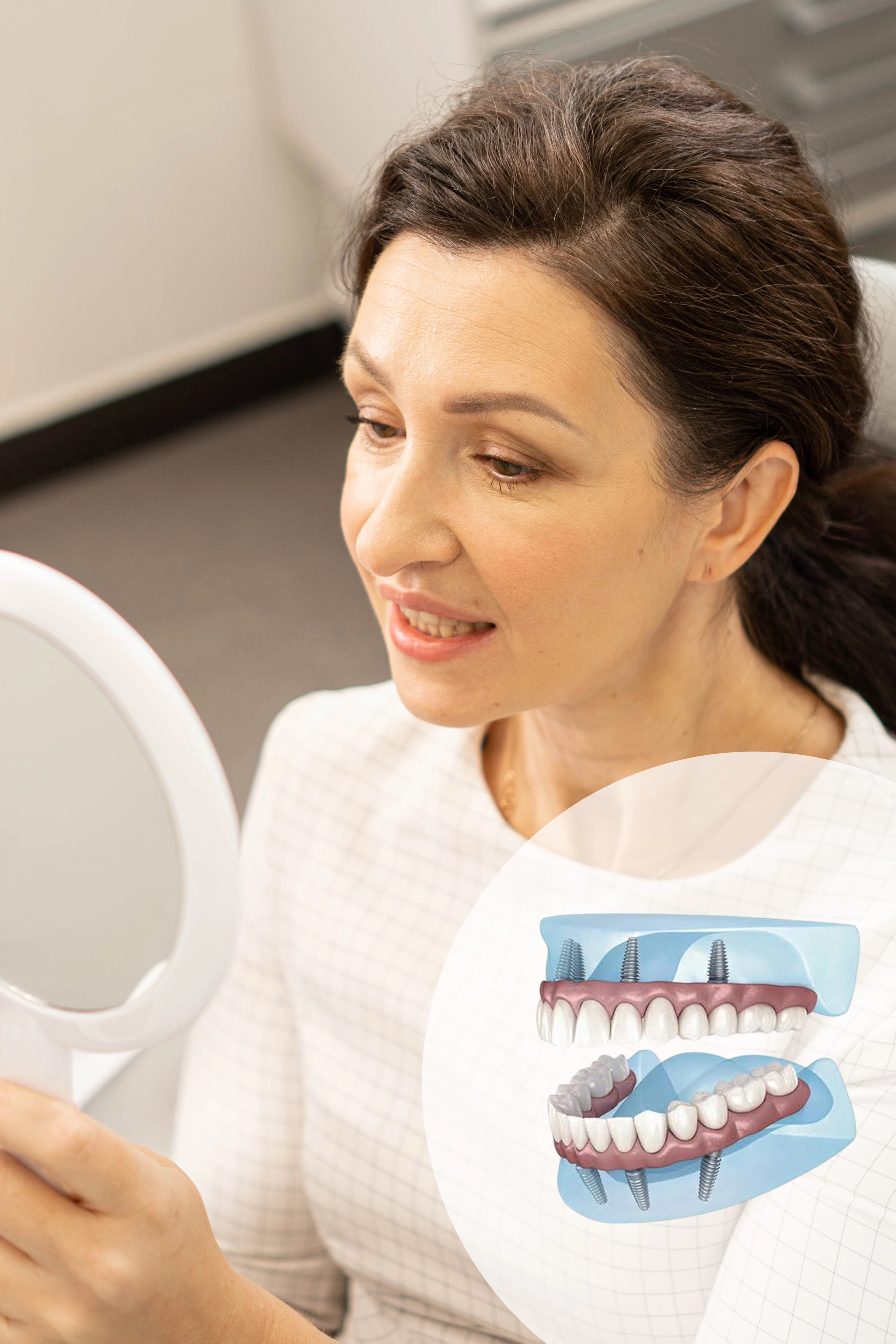 All-on-4 в СПб — полное протезирование на 4 имплантах от 198 000₽ | Диадент"